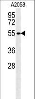 MMP14 Antibody - MMP14 Monoclonal Antibody western blot of A2058 cell line lysates (35 ug/lane). The MMP14 antibody detected the MMP14 protein (arrow). (8 ug/ml)
