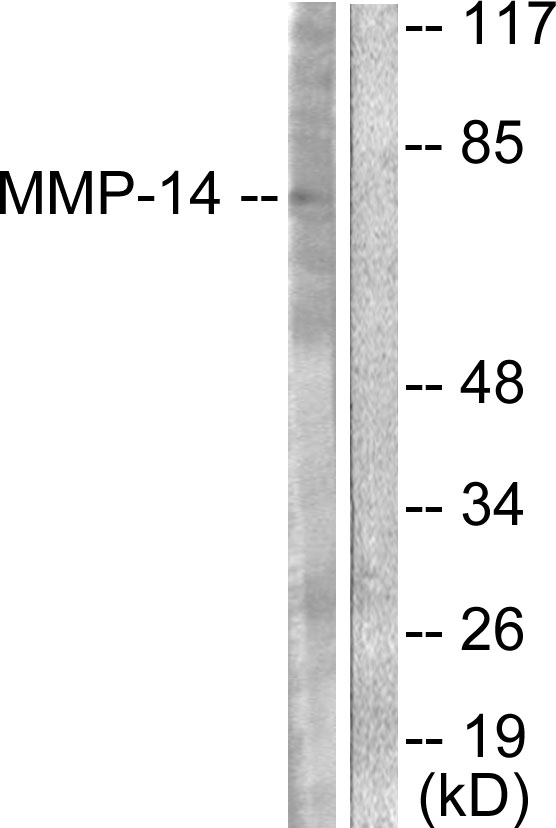 MMP14 Antibody - Western blot analysis of lysates from NIH/3T3 cells, using MMP-14 Antibody. The lane on the right is blocked with the synthesized peptide.