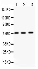 MMP14 Antibody - MMP14 antibody Western blot. All lanes: Anti MMP14 at 0.5 ug/ml. Lane 1: Human Placenta Tissue Lysate at 50 ug. Lane 2: HELA Whole Cell Lysate at 40 ug. Lane 3: U87 Whole Cell Lysate at 40 ug. Predicted band size: 55 kD. Observed band size: 55 kD.