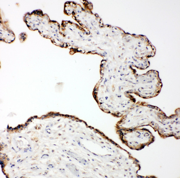MMP14 Antibody - MMP14 / MMP-14 antibody. IHC(P): Human Placenta Tissue.