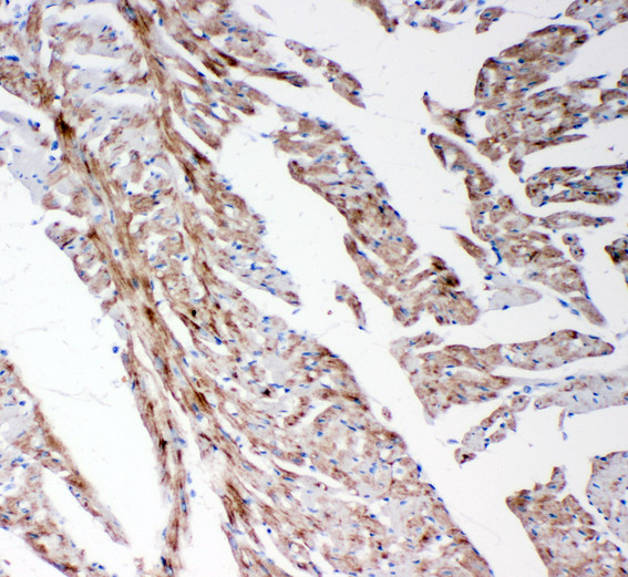 MMP14 Antibody - MMP14 / MMP-14 antibody. IHC(P): Rat Cardiac Muscle Tissue.