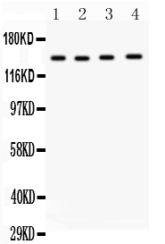 MMP14 Antibody - Anti-MMP14 antibody, Western blotting All lanes: Anti MMP14 at 0.5ug/ml Lane 1: Rat Spleen Tissue Lysate at 50ugLane 2: Human Placenta Tissue Lysate at 50ugLane 3: HELA Whole Cell Lysate at 40ugLane 4: A549 Whole Cell Lysate at 40ugPredicted bind size: 66KD Observed bind size: 150KD