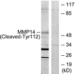 MMP14 Antibody - Western blot of extracts from 293 cells, treated with etoposide 25 uM 1h, using MMP14 (Cleaved-Tyr112) Antibody. The lane on the right is treated with the synthesized peptide.