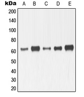 MMP14 Antibody - Western blot analysis of MMP14 expression in HeLa (A); HT1080 (B); MDMB23 (C); SP2/0 (D); mouse kidney (E); H9C2 (F) whole cell lysates.