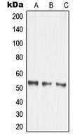 MMP14 Antibody - Western blot analysis of MMP14 expression in HEK293T (A); mouse kidney (B); rat brain (C) whole cell lysates.