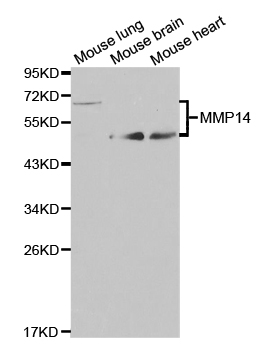 MMP14 Antibody - Western blot analysis of extracts of various cell lines.