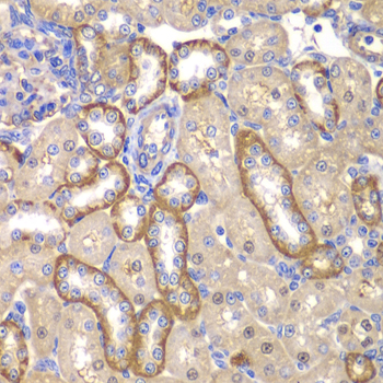 MMP14 Antibody - Immunohistochemistry of paraffin-embedded rat kidney tissue.
