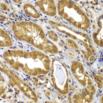 MMP14 Antibody - Immunohistochemistry of paraffin-embedded human kidney tissue.