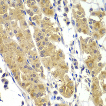MMP14 Antibody - Immunohistochemistry of paraffin-embedded human gastric tissue.