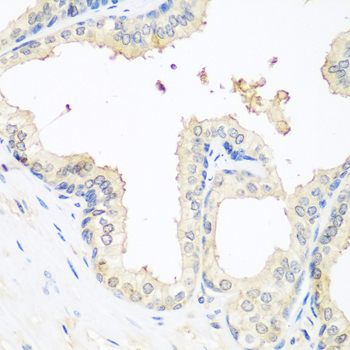 MMP14 Antibody - Immunohistochemistry of paraffin-embedded human prostate.