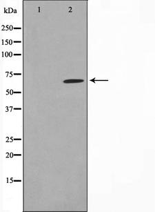 MMP14 Antibody - Western blot analysis on NIH-3T3 cell lysates using MMP14 antibody. The lane on the left is treated with the antigen-specific peptide.