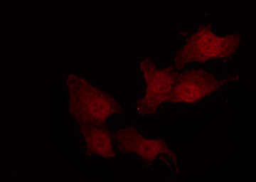 MMP14 Antibody - Staining NIH-3T3 cells by IF/ICC. The samples were fixed with PFA and permeabilized in 0.1% Triton X-100, then blocked in 10% serum for 45 min at 25°C. The primary antibody was diluted at 1:200 and incubated with the sample for 1 hour at 37°C. An Alexa Fluor 594 conjugated goat anti-rabbit IgG (H+L) Ab, diluted at 1/600, was used as the secondary antibody.