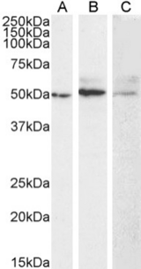 MMP14 Antibody - IF staining of HeLa cells.