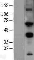 MMP14 Protein - Western validation with an anti-DDK antibody * L: Control HEK293 lysate R: Over-expression lysate