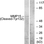 MMP15 Antibody - Western blot of extracts from COS7 cells, treated with etoposide 25 uM 1h, using MMP15 (Cleaved-Tyr132) Antibody. The lane on the right is treated with the synthesized peptide.