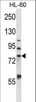 MMP15 Antibody - MMP15 Antibody western blot of HL-60 cell line lysates (35 ug/lane). The MMP15 antibody detected the MMP15 protein (arrow).