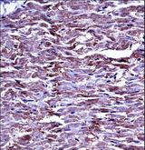 MMP15 Antibody - MMP15 Antibody immunohistochemistry of formalin-fixed and paraffin-embedded human heart tissue followed by peroxidase-conjugated secondary antibody and DAB staining.