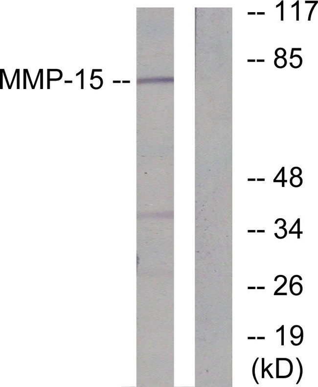 MMP15 Antibody - Western blot analysis of lysates from MDA-MB-435 cells, using MMP-15 Antibody. The lane on the right is blocked with the synthesized peptide.