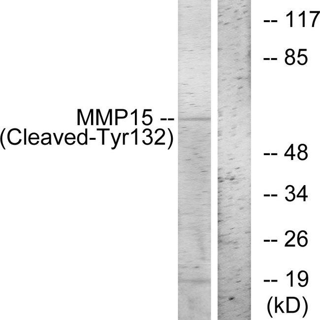 MMP15 Antibody - Western blot analysis of extracts from COS-7 cells, treated with etoposide (25uM, 1hour), using MMP15 (Cleaved-Tyr132) antibody.