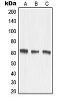 MMP15 Antibody - Western blot analysis of MMP15 expression in HeLa (A); mouse kidney (B); rat kidney (C) whole cell lysates.