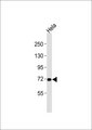 MMP15 Antibody - Anti-MMP15 Antibody at 1:1000 dilution + HeLa whole cell lysates Lysates/proteins at 20 ug per lane. Secondary Goat Anti-Rabbit IgG, (H+L),Peroxidase conjugated at 1/10000 dilution Predicted band size : 76 kDa Blocking/Dilution buffer: 5% NFDM/TBST.