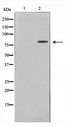 MMP15 Antibody - Western blot of MDA-MB-435 cell lysate using MMP15 Antibody