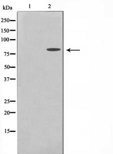 MMP15 Antibody - Western blot analysis on MDA-MB-435 cell lysates using MMP15 antibody. The lane on the left is treated with the antigen-specific peptide.