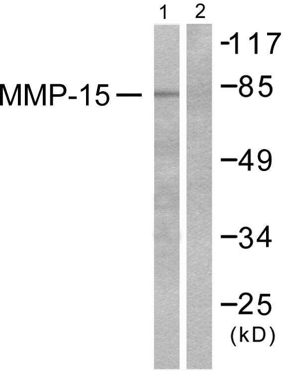 MMP15 Antibody - Western blot analysis of extracts from MDA-MB-435 cells, using MMP-15 antibody.