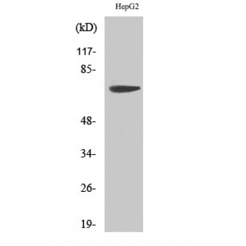 MMP16 Antibody - Western blot of MMP-16 antibody