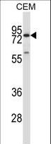 MMP16 Antibody - MMP16 Antibody western blot of CEM cell line lysates (35 ug/lane). The MMP16 antibody detected the MMP16 protein (arrow).