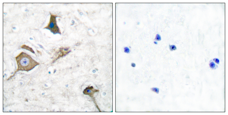 MMP16 Antibody - Immunohistochemistry analysis of paraffin-embedded human brain tissue, using MMP-16 Antibody. The picture on the right is blocked with the synthesized peptide.