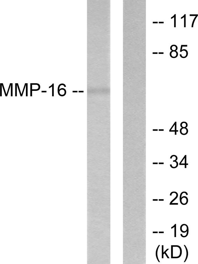 MMP16 Antibody - Western blot analysis of lysates from HepG2 cells, using MMP-16 Antibody. The lane on the right is blocked with the synthesized peptide.