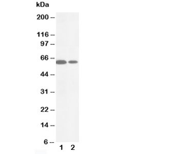 MMP16 Antibody - Western blot testing of MMP16 antibody and Lane 1: HeLa; 2: COLO320 cell lysate