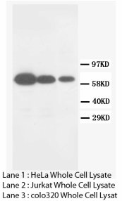 MMP16 Antibody -  This image was taken for the unconjugated form of this product. Other forms have not been tested.
