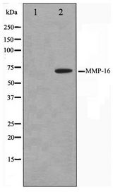 MMP16 Antibody - Western blot of HepG2 cell lysate using MMP16 Antibody