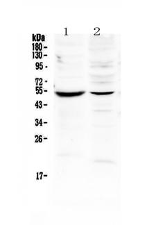 MMP16 Antibody - Western blot - Anti-MMP16/Mt3 Mmp Picoband Antibody