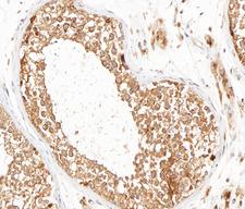 MMP16 Antibody - 1:100 staining human testis tissue by IHC-P. The tissue was formaldehyde fixed and a heat mediated antigen retrieval step in citrate buffer was performed. The tissue was then blocked and incubated with the antibody for 1.5 hours at 22 °C. An HRP conjugated goat anti-rabbit antibody was used as the secondary.