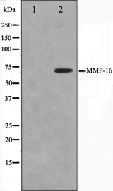 MMP16 Antibody - Western blot analysis on HepG2 cell lysates using MMP16 antibody. The lane on the left is treated with the antigen-specific peptide.