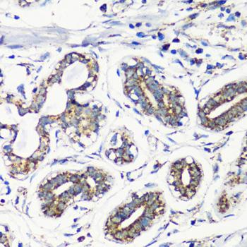 MMP16 Antibody - Immunohistochemistry of paraffin-embedded Human breast using MMP16 Polyclonal Antibody at dilution of 1:100 (40x lens).