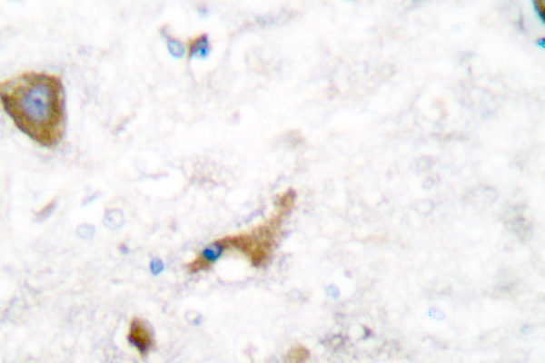 MMP16 Antibody - IHC of MMP-16 (T583) pAb in paraffin-embedded human brain tissue.