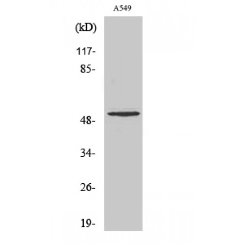 MMP17 Antibody - Western blot of Cleaved-MMP-17 (Q129) antibody