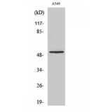 MMP17 Antibody - Western blot of Cleaved-MMP-17 (Q129) antibody