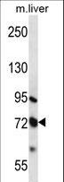 MMP17 Antibody - MMP17 Antibody western blot of mouse liver tissue lysates (35 ug/lane). The MMP17 antibody detected the MMP17 protein (arrow).