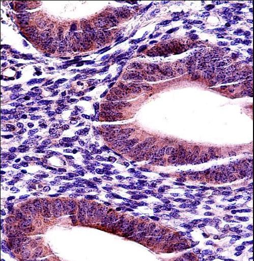MMP17 Antibody - MMP17 Antibody immunohistochemistry of formalin-fixed and paraffin-embedded human uterus tissue followed by peroxidase-conjugated secondary antibody and DAB staining.
