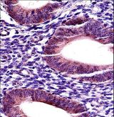 MMP17 Antibody - MMP17 Antibody immunohistochemistry of formalin-fixed and paraffin-embedded human uterus tissue followed by peroxidase-conjugated secondary antibody and DAB staining.