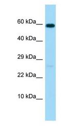 MMP17 Antibody - MMP17 / MMP-17 antibody Western Blot of Jurkat.  This image was taken for the unconjugated form of this product. Other forms have not been tested.