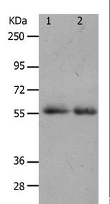 MMP17 Antibody - Western blot analysis of K562 cell and human colon cancer tissue, using MMP17 Polyclonal Antibody at dilution of 1:900.