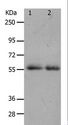 MMP17 Antibody - Western blot analysis of K562 cell and human colon cancer tissue, using MMP17 Polyclonal Antibody at dilution of 1:900.