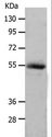 MMP17 Antibody - Western blot analysis of Human colon cancer tissue, using MMP17 Polyclonal Antibody at dilution of 1:550.