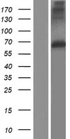 MMP17 Protein - Western validation with an anti-DDK antibody * L: Control HEK293 lysate R: Over-expression lysate